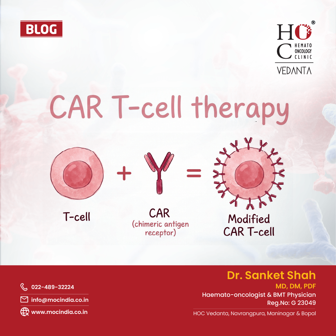 CAR T-Cell Therapy for Blood Cancer | Dr Sanket Shah